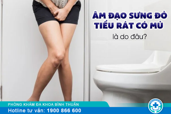 Âm đạo sưng đỏ, tiểu rát có mủ là do đâu?