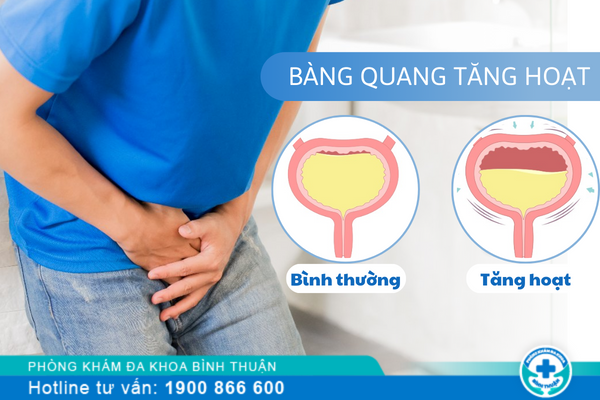 Bàng quang tăng hoạt ảnh hưởng thế nào tới sức khỏe