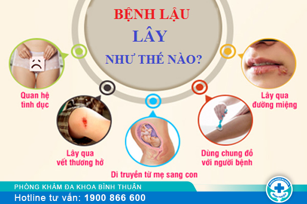 Nguyên nhân bị bệnh lậu do đâu? Làm sao để chữa trị?