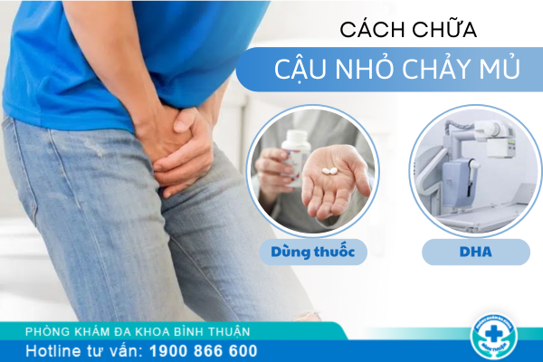 Cách điều trị cậu nhỏ chảy mủ