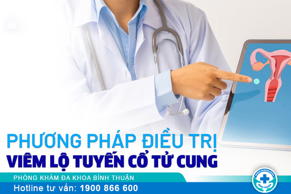 Điều trị viêm lộ tuyến cổ tử cung bằng kỹ thuật hiện đại