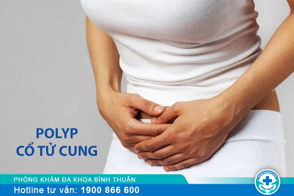 Cách điều trị polyp cổ tử cung an toàn và hiệu quả hiện nay