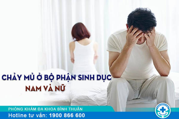 Bị chảy mủ ở bộ phận sinh dục nam và nữ có nguy hiểm không?