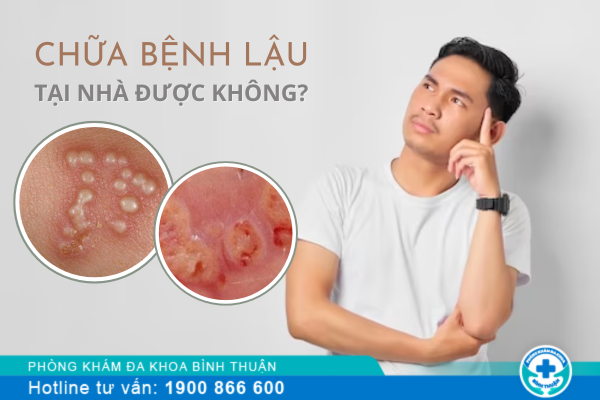 Những cách chữa bệnh lậu tại nhà có hiệu quả không?