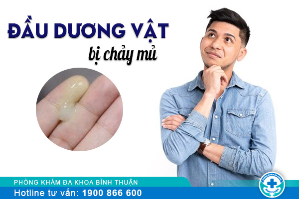 Nguyên nhân đầu dương vật chảy mủ là gì?