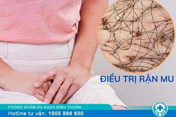 Dấu hiệu nhận biết và điều trị rận mu