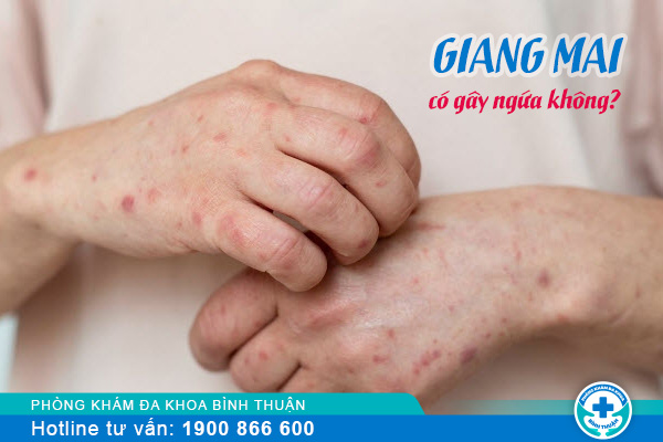 Giang mai có ngứa không? Phải làm sao để điều trị căn bệnh này?