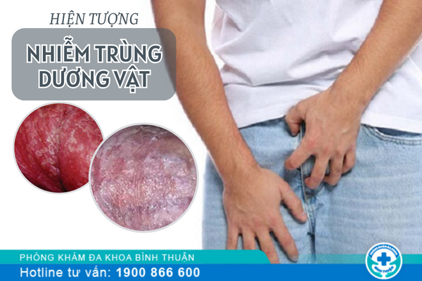 Hiện tượng nhiễm trùng dương vật ở nam giới