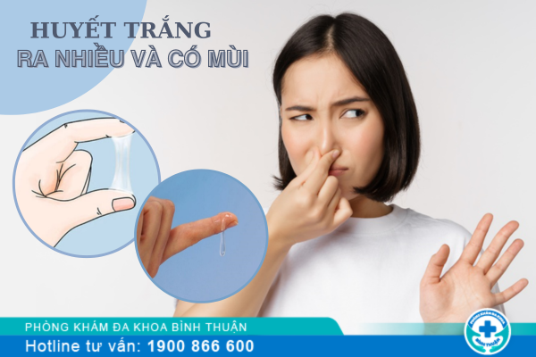 Khí hư ra nhiều và có mùi hôi điều trị thế nào?