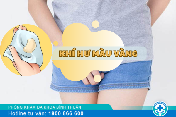 Khí hư có màu vàng là bệnh gì?