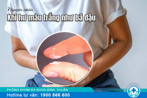 Ra nhiều khí hư màu trắng như bã đậu do bệnh gì ở nữ?