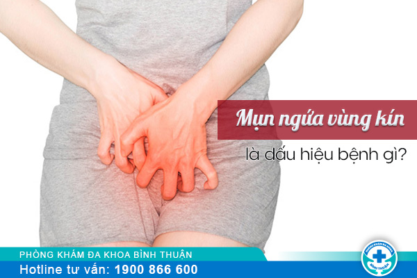 Mụn ngứa vùng kín là dấu hiệu bệnh gì?