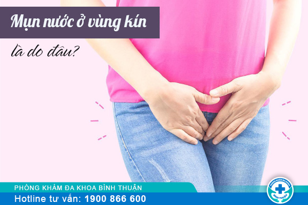 Mụn nước ở vùng kín là bệnh gì? có nguy hiểm không?