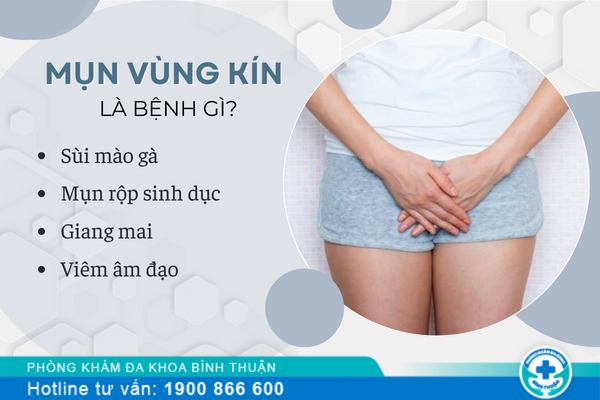 Mụn vùng kín dấu hiệu bệnh gì? chữa như thế nào?