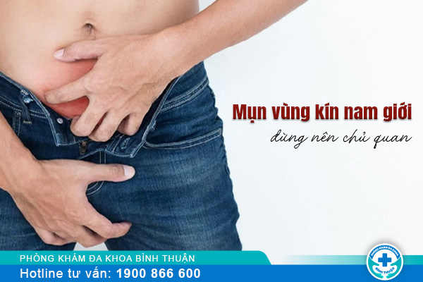 Mụn vùng kín nam giới đừng nên chủ quan