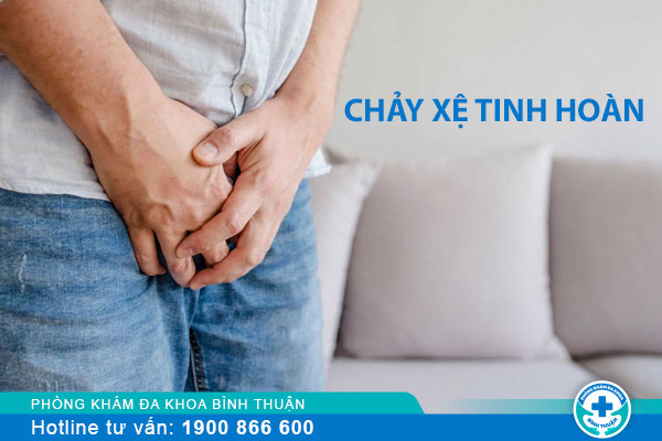 Nam giới mắc các vấn đề tinh hoàn bị chảy xệ có sao không?