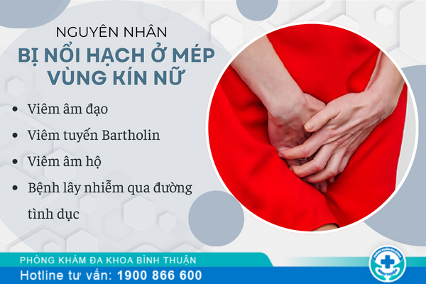 Bị nổi hạch ở mép vùng kín nữ là dấu hiệu của bệnh gì?