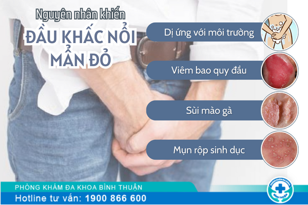 Nguyên nhân khiến đầu khấc nổi mẫn đỏ