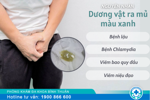 Dương vật ra mủ màu xanh bệnh gì?