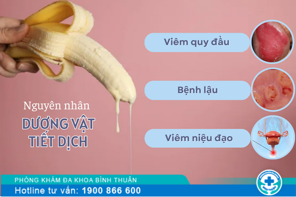 Dương vật tiết dịch là dấu hiệu của bệnh gì?