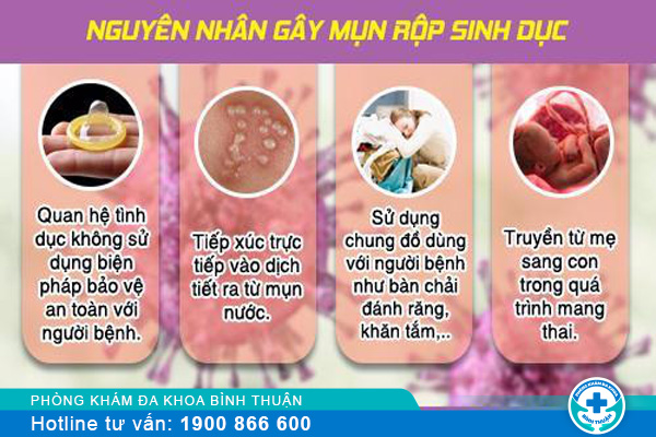 Một số nguyên nhân mụn rộp sinh dục cần lưu ý