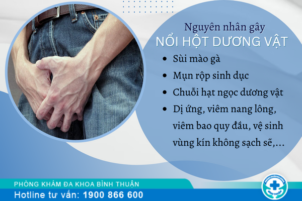 Cảnh báo nổi hột ở dương vật nam giới