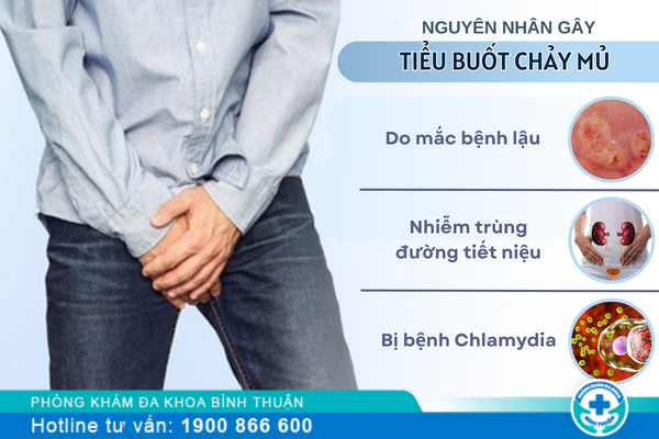 Tiểu buốt chảy mủ là bệnh gì?