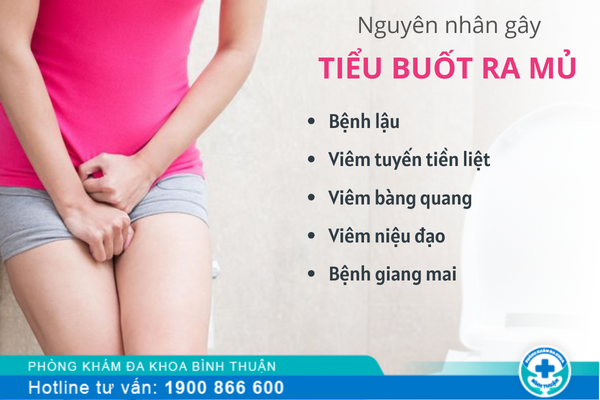 Cách điều trị tiểu buốt ra mủ