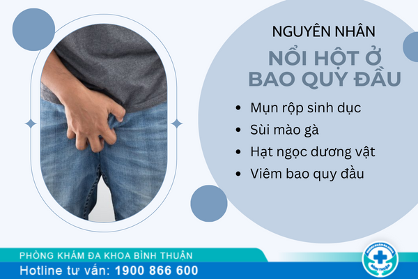 Nổi hột ở bao quy đầu là bệnh gì?