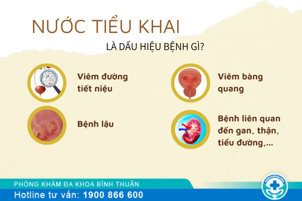 Nước tiểu khai là dấu hiệu bệnh gì?