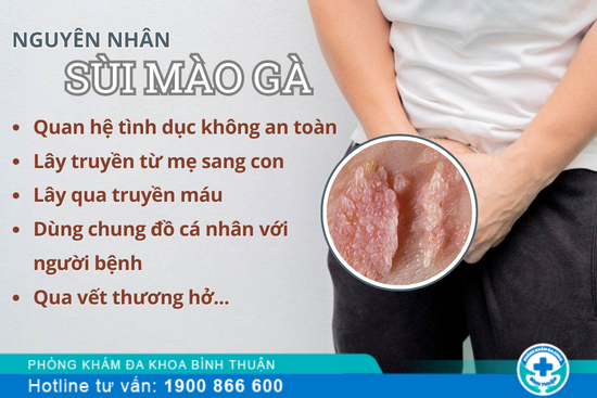 Sùi mào gà là bệnh gì? Nguyên nhân, dấu hiệu và cách chữa