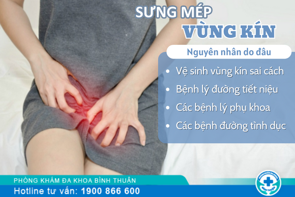 Bị sưng mép vùng kín và hướng dẫn điều trị an toàn