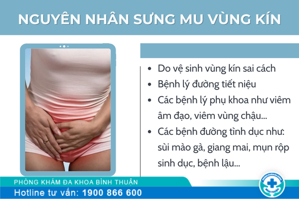 Mu vùng kín bị sưng nguyên nhân do đâu?