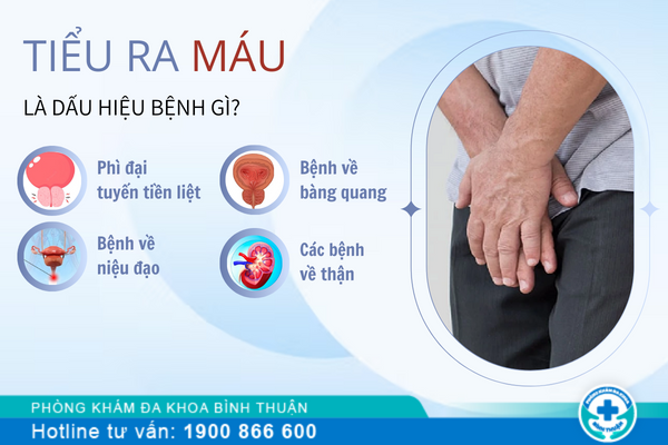 Tiểu ra máu là bệnh gì ở nam?