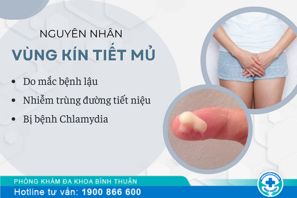 Nguyên nhân vùng kín tiết mủ là gì?