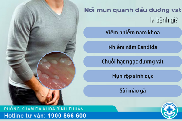 Nổi mụn quanh đầu dương vât là bệnh gì?