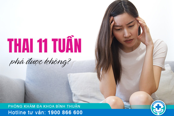 Phá thai 11 tuần tuổi có được không? Có an toàn không?