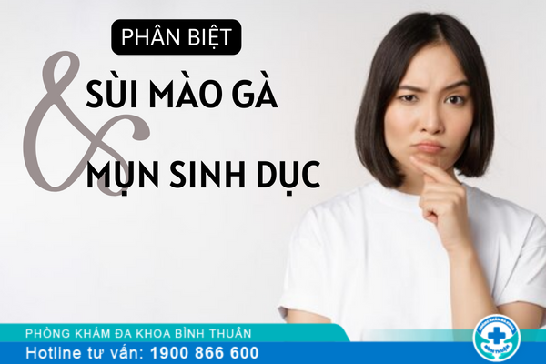 Phân biệt mụn sinh dục và sùi mào gà