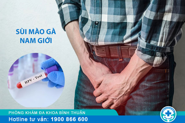 Phát hiện dấu hiệu sùi mào gà ở nam giới