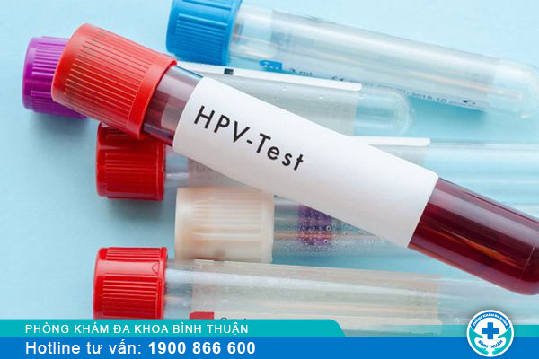 Phụ nữ nên xét nghiệm HPV định kỳ bao lâu 1 lần?