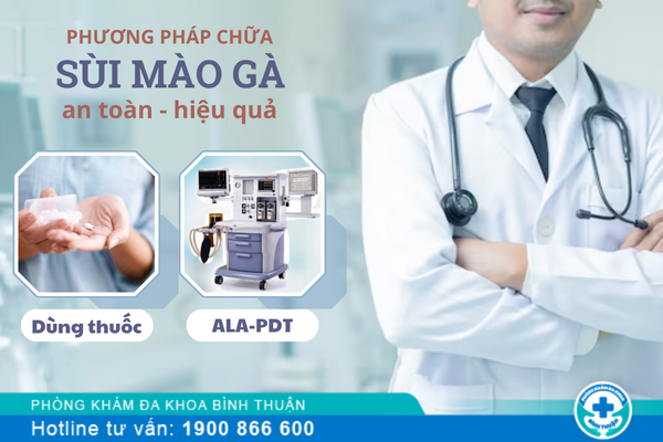 Chữa trị sùi mào gà bằng cách nào?