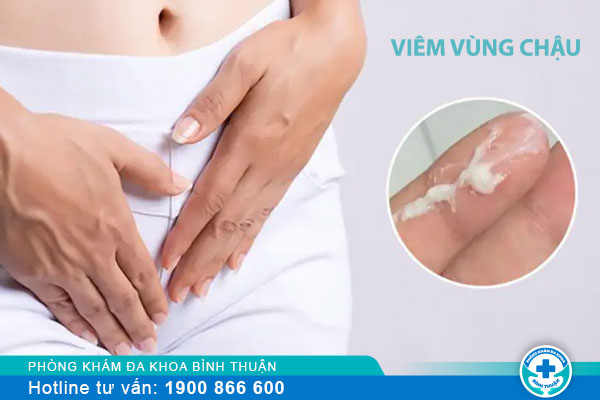 Sớm phát hiện với các biểu hiện của viêm vùng chậu