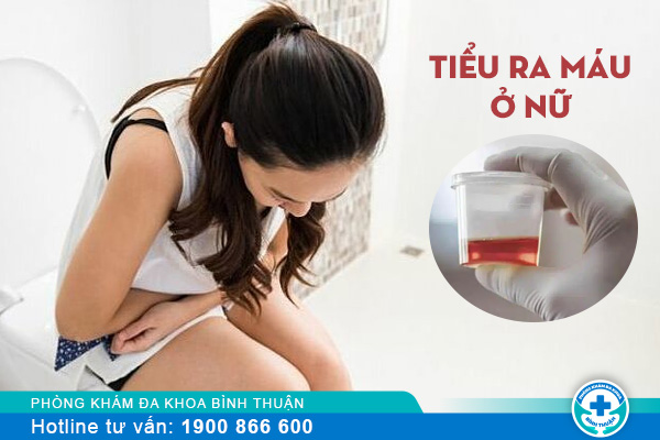 Nguyên nhân tiểu ra máu ở phụ nữ