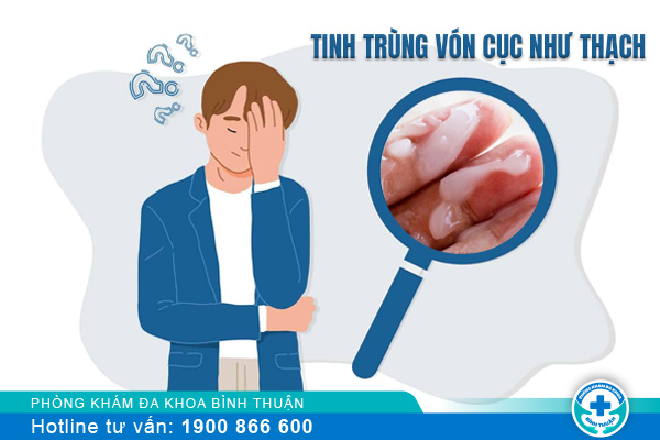 Tinh trùng vón cục như thạch là bị làm sao?