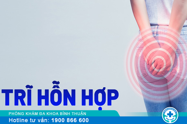 Trĩ hỗn hợp có nên phẫu thuật và địa chỉ điều trị uy tín