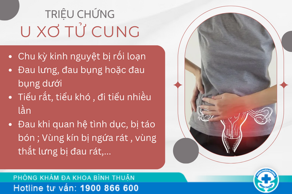 Triệu chứng và nguyên nhân của bệnh u xơ tử cung là gì?