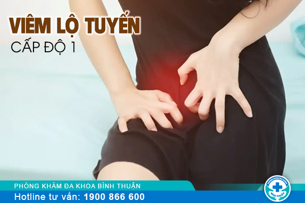 Phương pháp điều trị viêm lộ tuyển cấp độ 1 hiệu quả