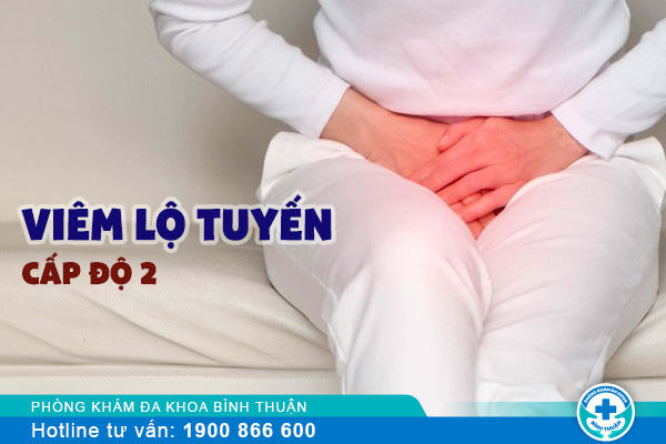 Biểu hiện của viêm lộ tuyến cấp độ 2