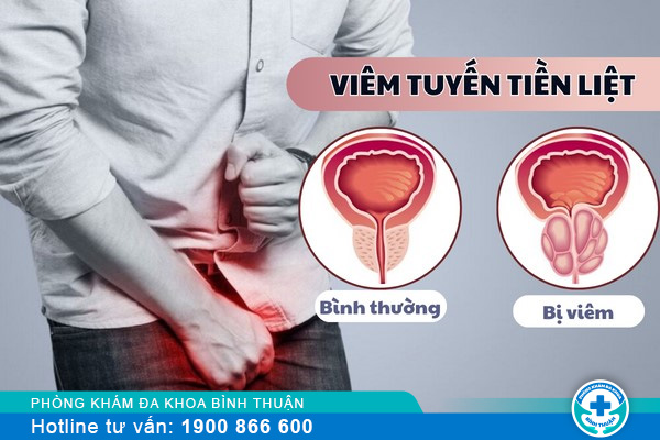 Cách điều trị tiền liệt tuyến hiệu quả