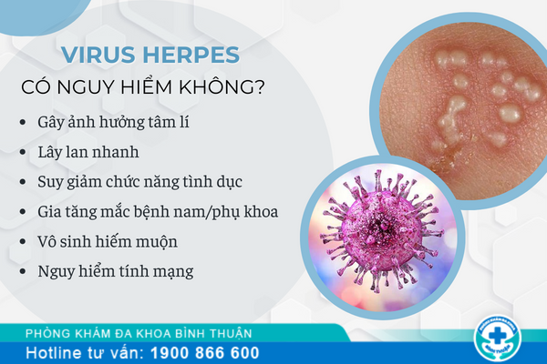 Virus herpes có nguy hiểm không?